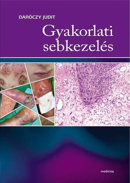 Utolsó példányok